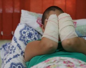 Homem que decepou mãos da ex-companheira tem pena reduzida