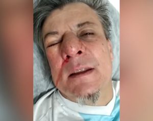 “Me deu um murro na cara como um covarde” diz Boca Aberta no hospital