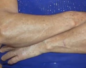 Mulher de 65 anos é estuprada em matagal atrás da UEL
