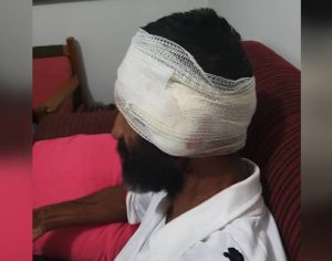 Homem sofre ataque de pitbulls e quase tem orelha arrancada em Cambé