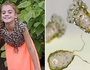 Após nadar em rio, menina contrai ameba comedora de cérebro e morre