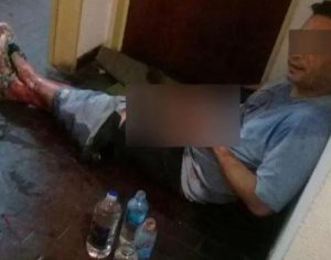 Mulher corta pênis de amante após ter vídeos íntimos vazados