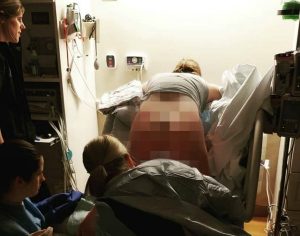 Foto rara mostra como os ossos da mãe se movem durante o parto