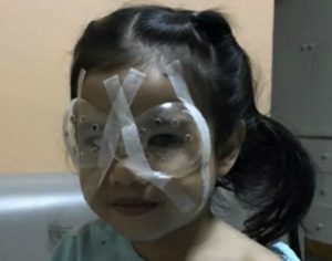Menina de 4 anos faz cirurgia nos olhos após uso excessivo de celular