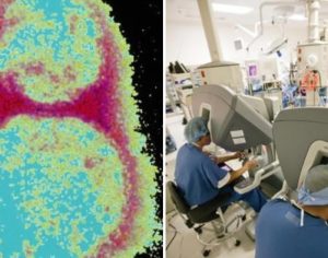 Vírus que mata todo tipo de câncer começa a ser testado em humanos