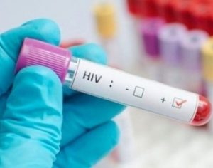 Cientistas descobrem formas de eliminar totalmente vírus HIV das células