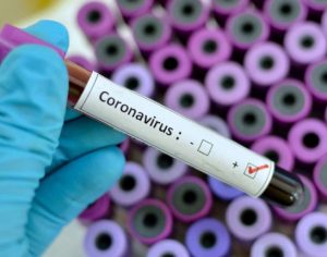 Infectado pelo coronavírus pode não ter sintoma, aponta estudo