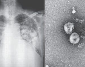 Epidemia tem casos invisíveis, e coronavírus pode infectar 130 mil em dez dias, diz novo estudo