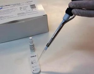 Laboratório da UEL faz testes rápidos para detecção de anticorpos da covid-19