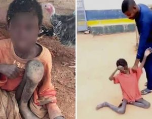 Menino é resgatado após viver 2 anos acorrentado e comendo ração