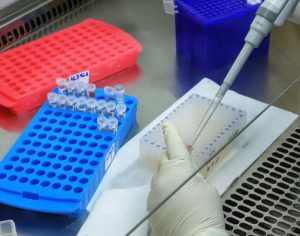Boletim: Londrina confirma mais um óbito e 181 casos de covid-19
