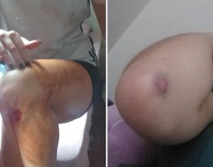 Jovem é atacada enquanto corria no aterro do Lago Igapó em Londrina