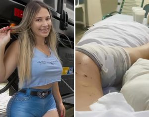 Caminhoneira Aline Ouriques explica acidente e posta foto em hospital