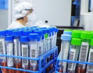 Londrina volta a registrar mais de 100 casos de covid-19 em um dia