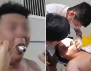 Vídeo: homem fica com lâmpada presa na boca ao tentar fazer desafio