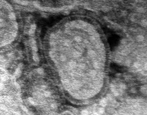 Criança de apenas 1 ano morre vítima de metapneumovírus no PR