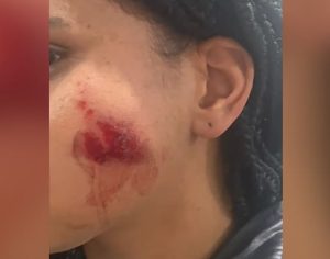 Menina de 12 anos é ferida por bala de borracha em ação da PM em Londrina