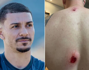 Alison é agredido e funcionários do LEC ficam feridos após jogo