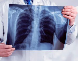 Congresso discute o presente e o futuro da radiologia em Curitiba